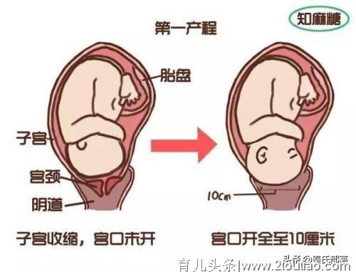 生孩子要普及无痛分娩了吗？随童心妈妈看看有哪些试点医院吧