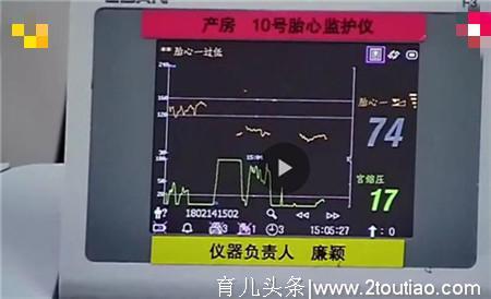 女子顺产用尽办法催产75小时，没有谁能比母亲更伟大！