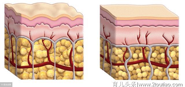 浅析剖腹产病人术后怎么护理？别不当回事