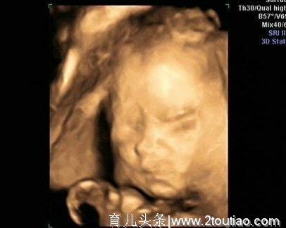 孕妈妈做大排畸产检时，胎宝宝为何总挡住脸？孕妇应注意些什么？