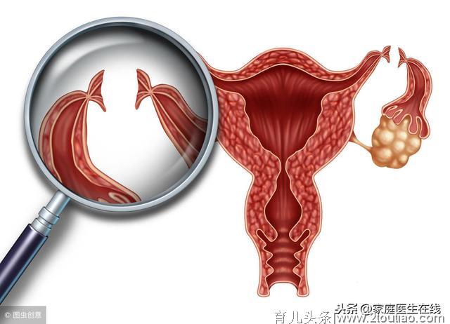 女人私房话：7个问题没解决，女人容易发生宫外孕！