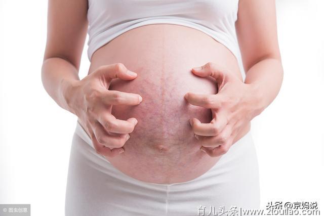 5个孕期常见表现，可能是血糖异常征兆，别不当回事儿