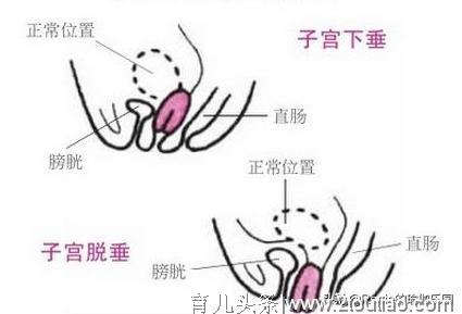 有人从孕期到产后身轻如燕，有人却因一种痛被折磨到怀疑人生