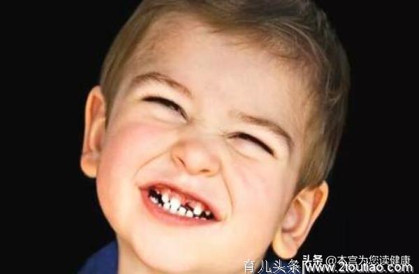 为什么孩子的牙齿黑了？其实是妈妈惹的祸