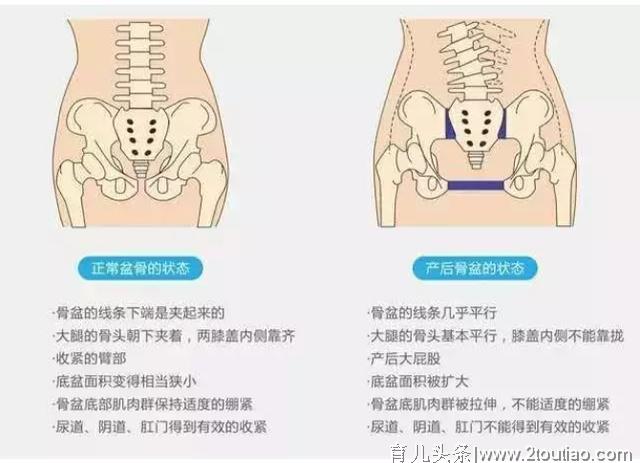 产后护理,盆底肌训练一定要注意