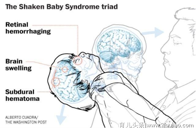 一件再常见不过的动作，却可能让孩子智力迟缓甚至死亡