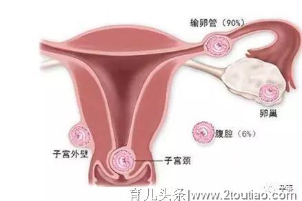 有一种怀孕叫生化妊娠：你流产了都不知道！