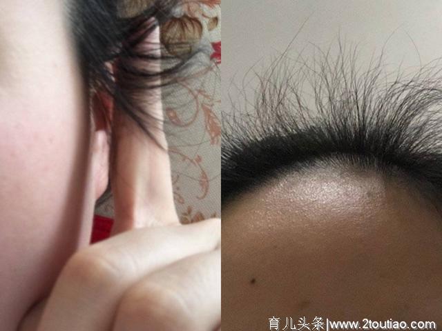 新妈妈产后脱发怕变“秃”，拯救产后脱发，先把这几件事儿做好