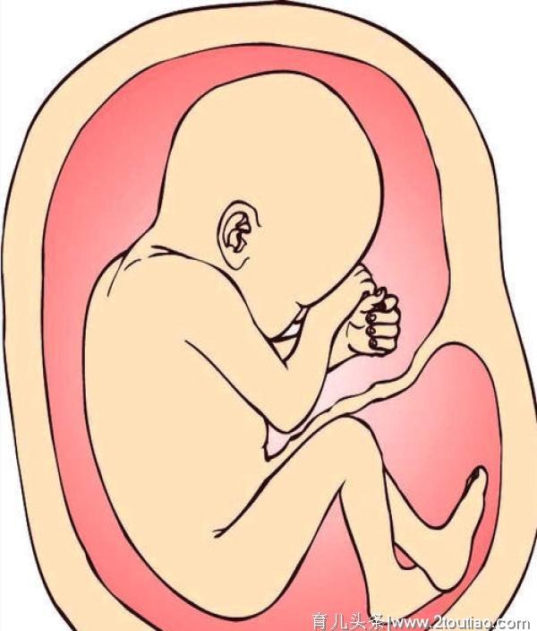 胎儿缺氧离不开5大原因，生活坚持“3要”，避免胎儿急性缺氧