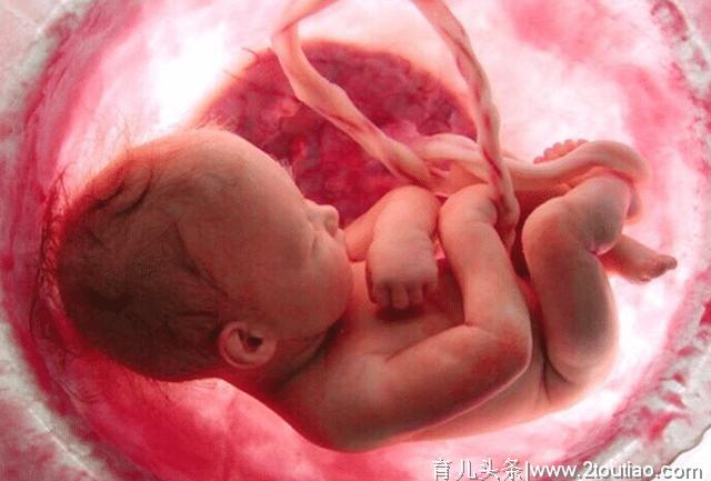 怀孕后，这几种胎儿不建议留下，家人和孩子都会遭罪