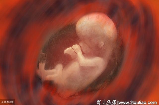 孕35周羊水指数20.8厘米，医生说羊水偏多，可能是胎儿畸形引起的