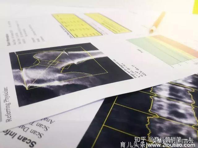 最新24款宝宝用品黑名单，好多父母还在用！快告诉身边的人！