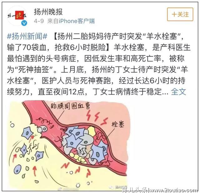 女明星自曝产后尿失禁！比生孩子更可怕的是这些后遗症…