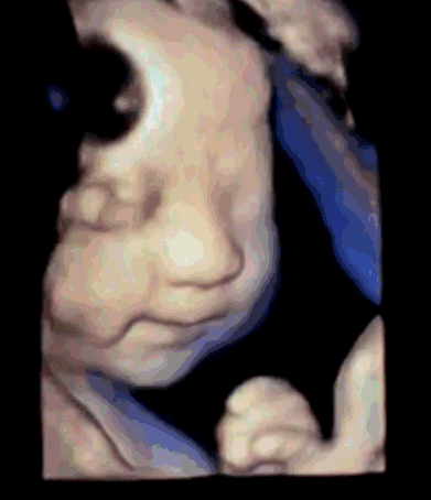 6个月胎儿需要哪些营养？这4种营养必不可少，促进胎儿大脑的发育