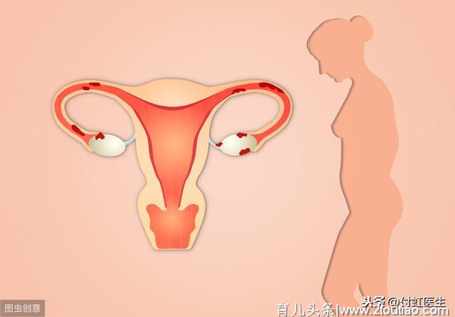 怀孕了发现子宫肌瘤，必须手术吗？会伤害宝宝吗？