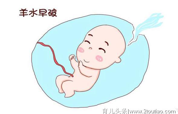 孕期孕妈要预防羊水早破，特别是孕晚期的时候，孕妈不宜做这些事