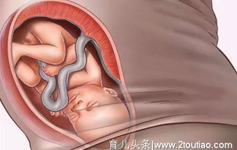 怀孕能按摩吗？胎儿双肾不一样大有事吗？