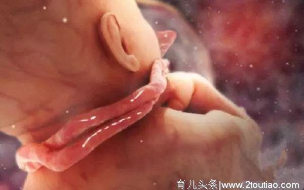 脐带绕颈对胎儿很危险，分娩时该选择顺产还是剖宫产？