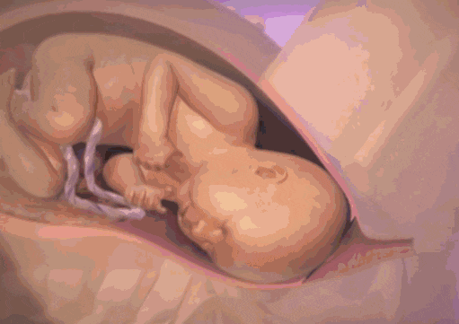 孕妇须知：分娩两个小时了，宝宝的头还没有下来，会有什么危险吗