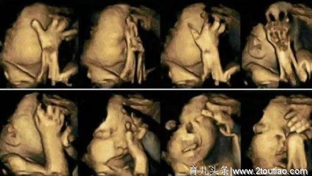 孕期产检，孕妈第一次看到胎儿，结果也是最后一次