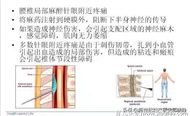 很多产后妈妈都不知道，产后腰疼的原因竟然是它？#清风计划#