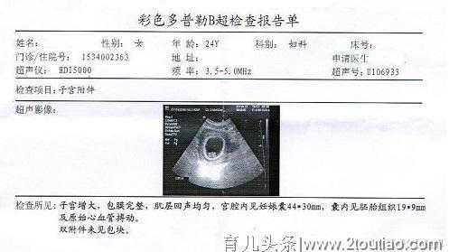 关于孕期B超，这6点孕妈要做到心中有数！