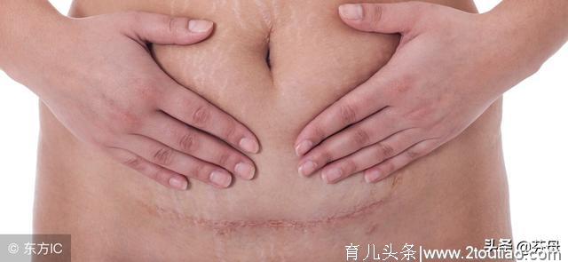 顺产好还是剖腹好？妈妈们产后护理下面几点一定要知道