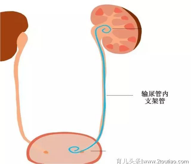 孕期遇到这种“腰痛”，千万别拖…