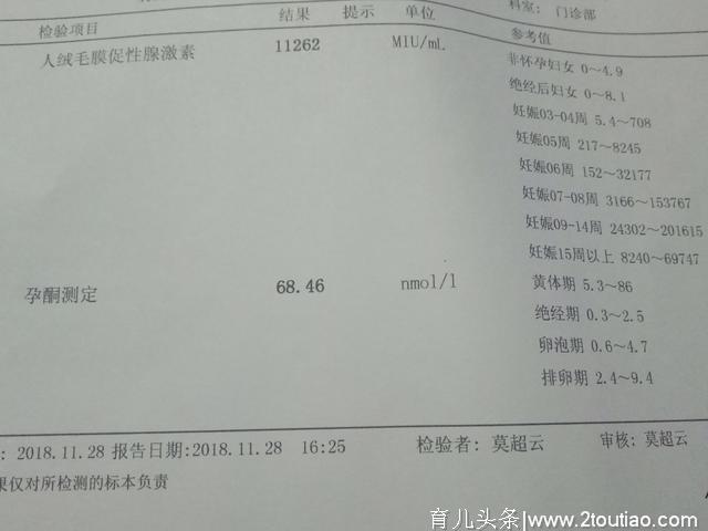 你是怎么知道自己怀孕了？身体有这些变化说明你怀孕了！要当妈了