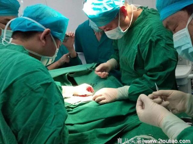 不是所有女人都能剖腹产，若你是这3种孕妈，做好顺产的准备