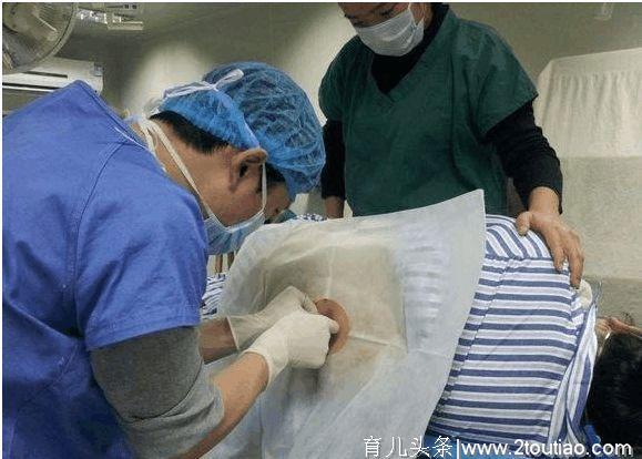 剖腹产的这3个“后遗症”对女性伤害很大，特别是第一个，别忽视