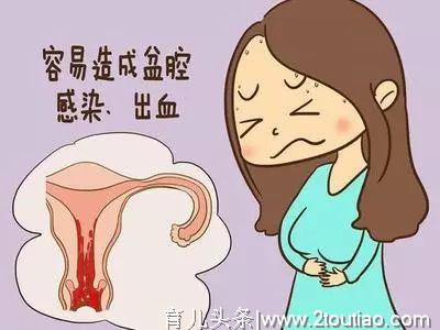 剖腹产后多久可以同房？过早同房的危害自己要知道，避免受罪！