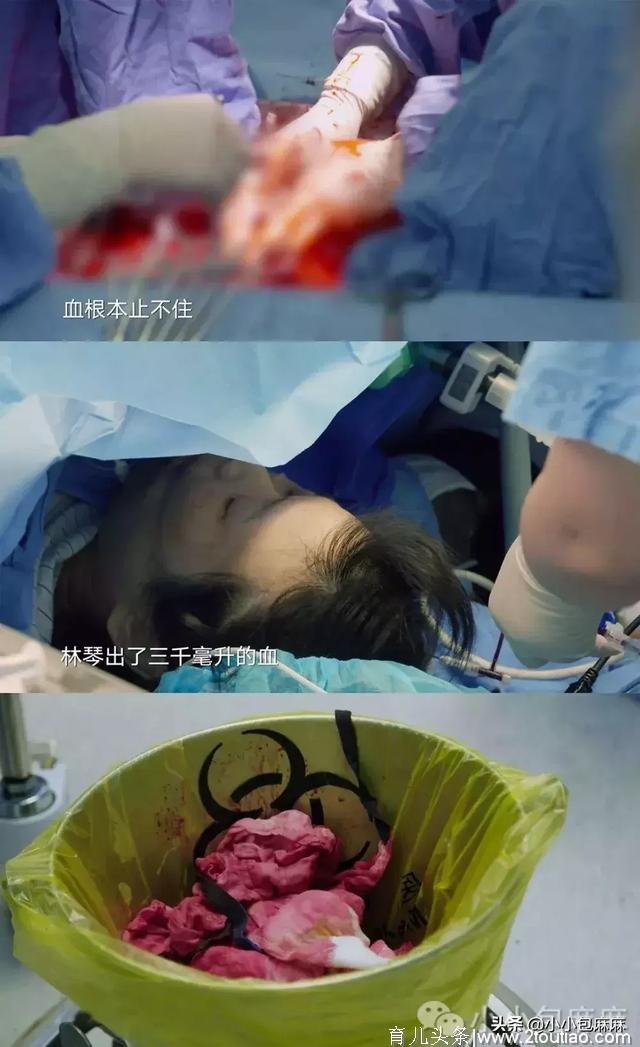 3分钟剖腹产视频曝光，哪个女人不是在用命生孩子…