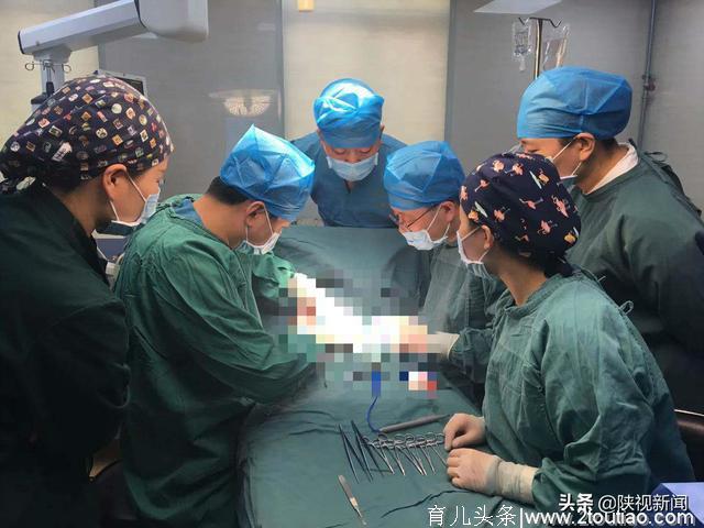 百天婴儿接受特殊“剖腹产”手术   取出一“寄生胎”