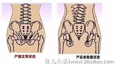 不管是剖腹产还是顺产，坐月子坚持十到要点，让自己年轻30岁