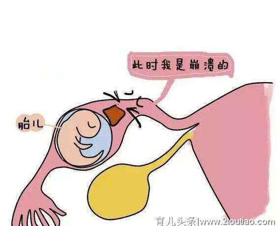 为什么那么多女人宫外孕？这几点原因，跟男人脱不了关系！