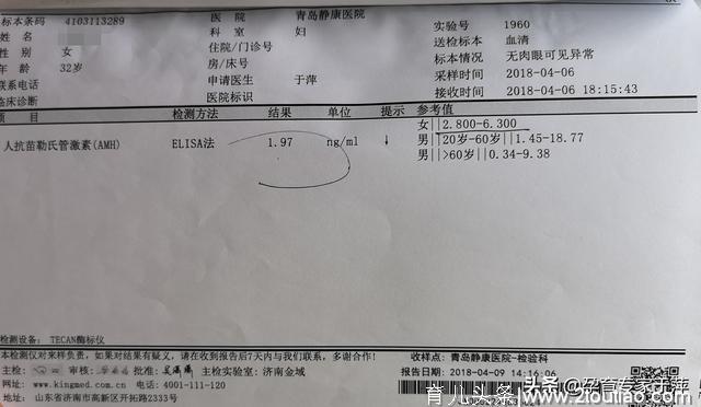 备孕女性，卵巢功能怎么样，这个检查一定要做