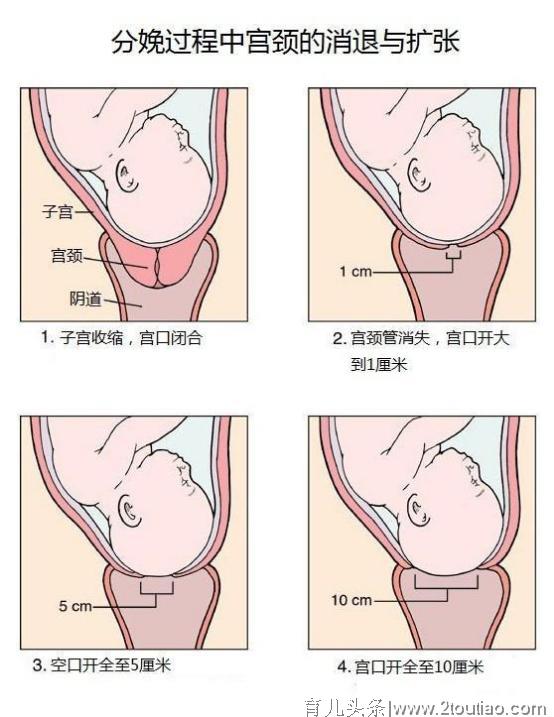 为什么能不能顺产，产科医生“掐指一算”就知道？门道在这里！