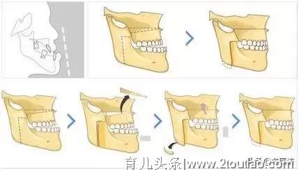 关爱儿童健康，从【齿】开始