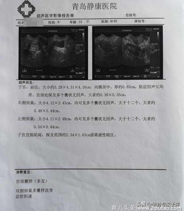 多囊卵巢+输卵管性不孕，3年备孕终于怀孕