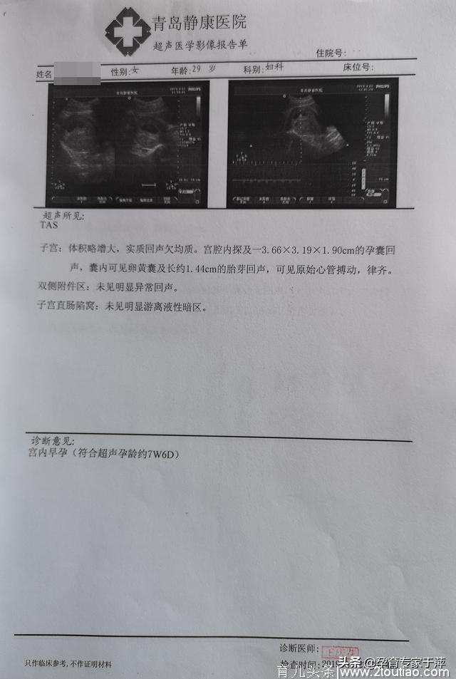 多囊卵巢+输卵管性不孕，3年备孕终于怀孕