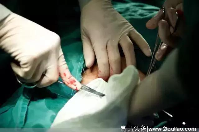 100张剖腹产过程照片，看过的湖北人都哭了！