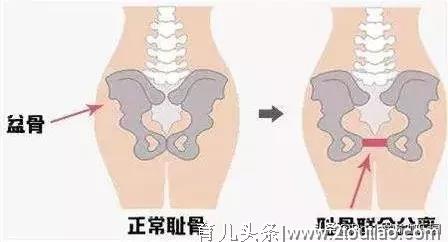 有一种痛可能从怀孕到生娃一路相随，只崩溃？妈妈们不妨做这些