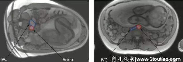 十月怀胎不容易，孕期睡姿有讲究