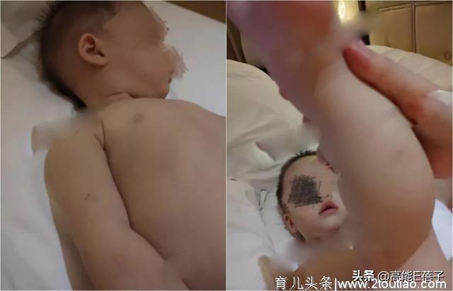 郑刚斥女星产后虐待儿子才暴力抢回，网友：这真的不是蚊子咬的吗