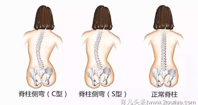 各位父母，孩子10岁前别忘了做脊柱检查，关乎孩子健康和身高