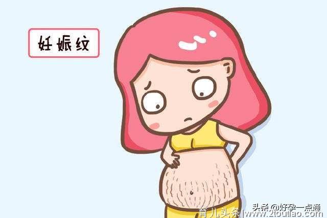 孕期身体这几处会变黑，说明宝宝很健康，看你中了几点