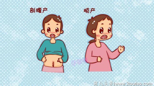 第四期：剖腹产究竟是种什么体验？