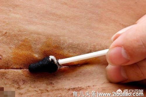 顺产和剖腹产的产后护理，你做正确了吗？来看看正确的护理方法