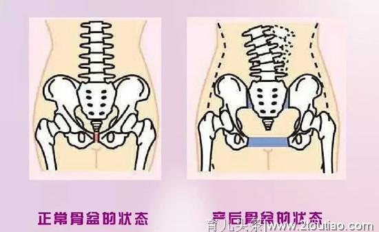 提醒：不想产后未老先衰，这九个底线要守住，不然月子白熬还落病